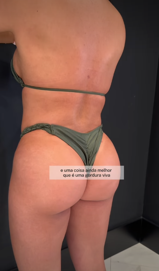 gluteo-img