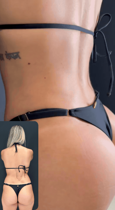 gluteo-v-att-p