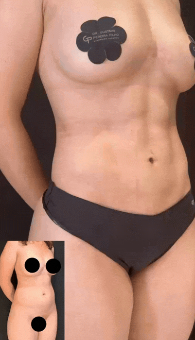 md-video-2
