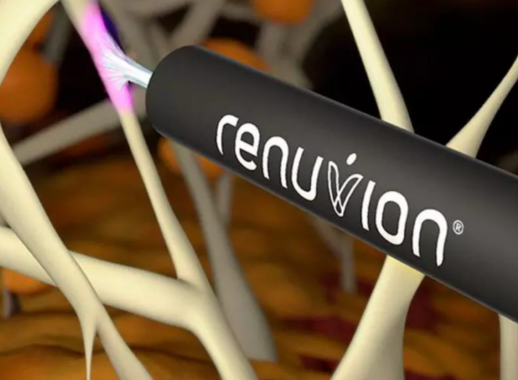 renuvion-img